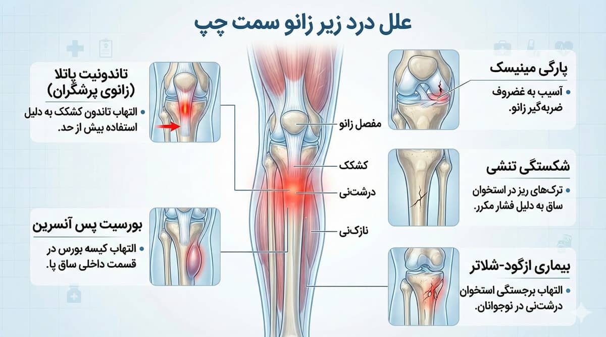 علت درد زیر زانو سمت چپ
