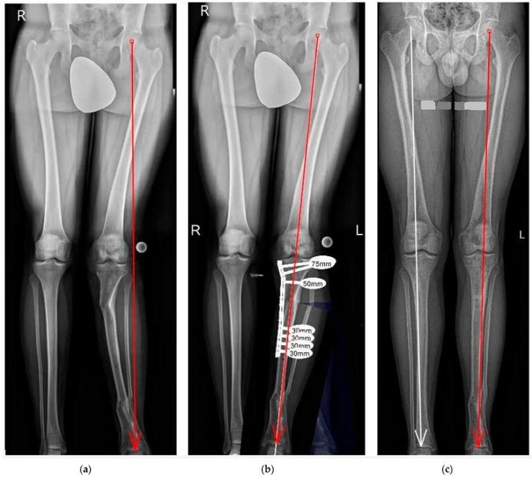 اصلاح ناهنجاری‌های اسکلتی