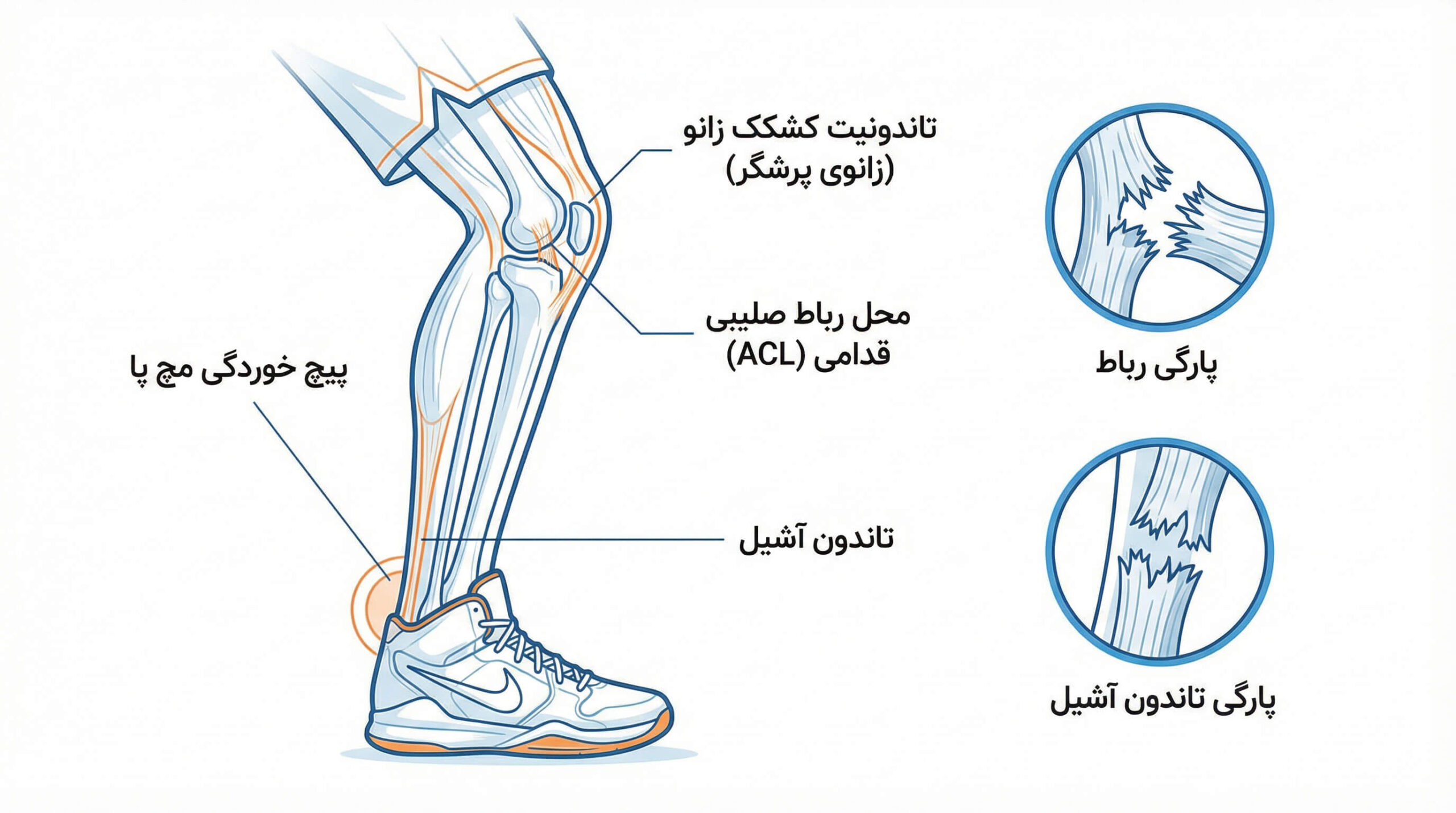 آسیب‌های بسکتبال و والیبال