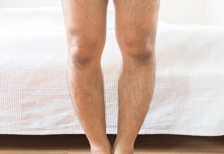 سابقه خانوادگی پای پرانتزی