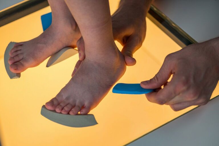 پای صاف در کودکان