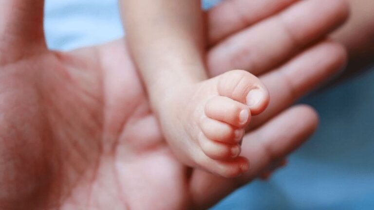 پای پرانتزی در کودکان