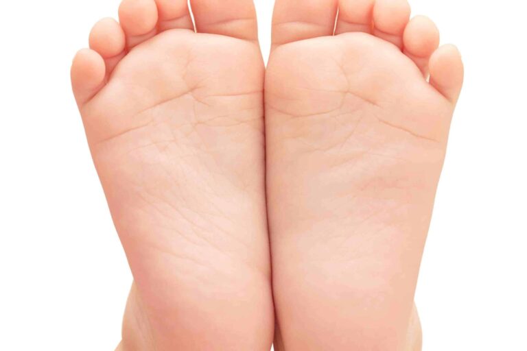 کف پای صاف در هر سن