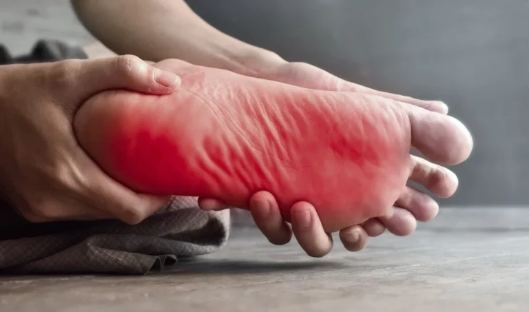 مشکلات مربوط به داغی کف پا